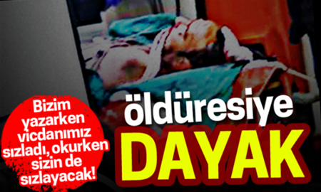 Engelli Adamı Öldüresiye Dövdüler!