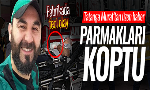 Fabrikada feci olay! Parmakları koptu..