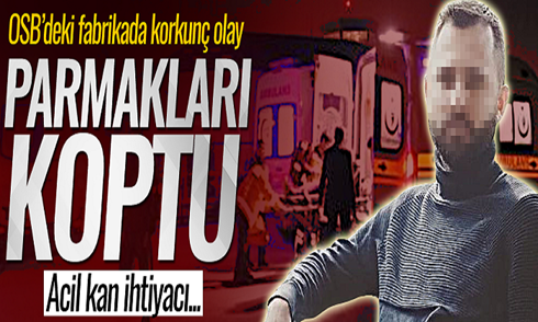 OSB’deki fabrikada korkunç olay! Parmakları koptu..