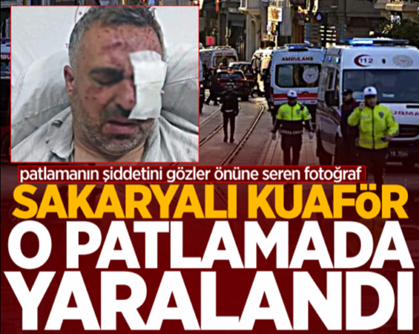 Taksim’deki patlamada Sakaryalı esnaf da yaralandı!